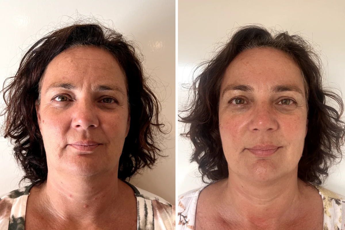 De toekomst van epigenetische skincare is er al