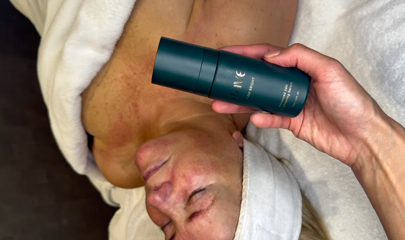 EAVE TREATMENT - SKIN SURGERY